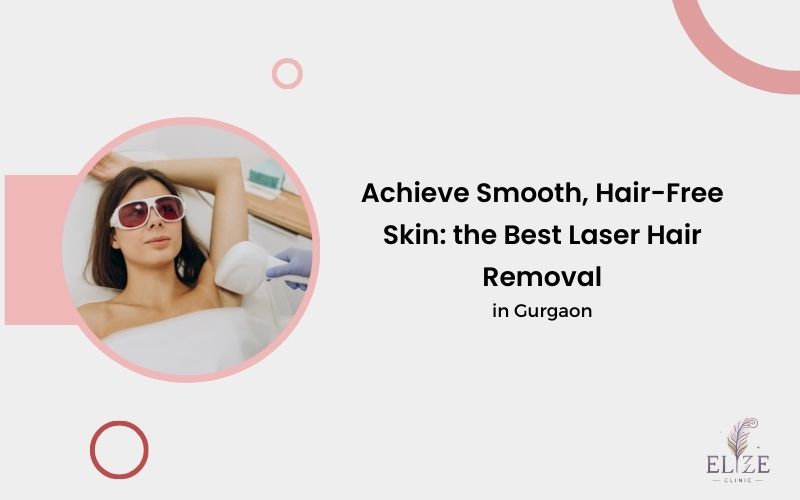 best laser hair removal in Gurgaon