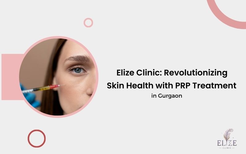 PRP treatment in Gurgaon