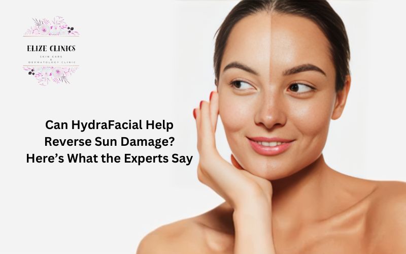 hydra facial in gurgaon