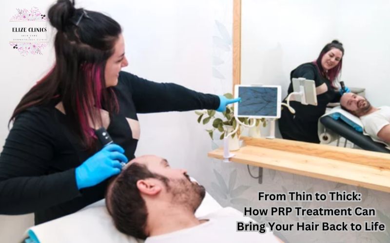 PRP Treatment for Hair